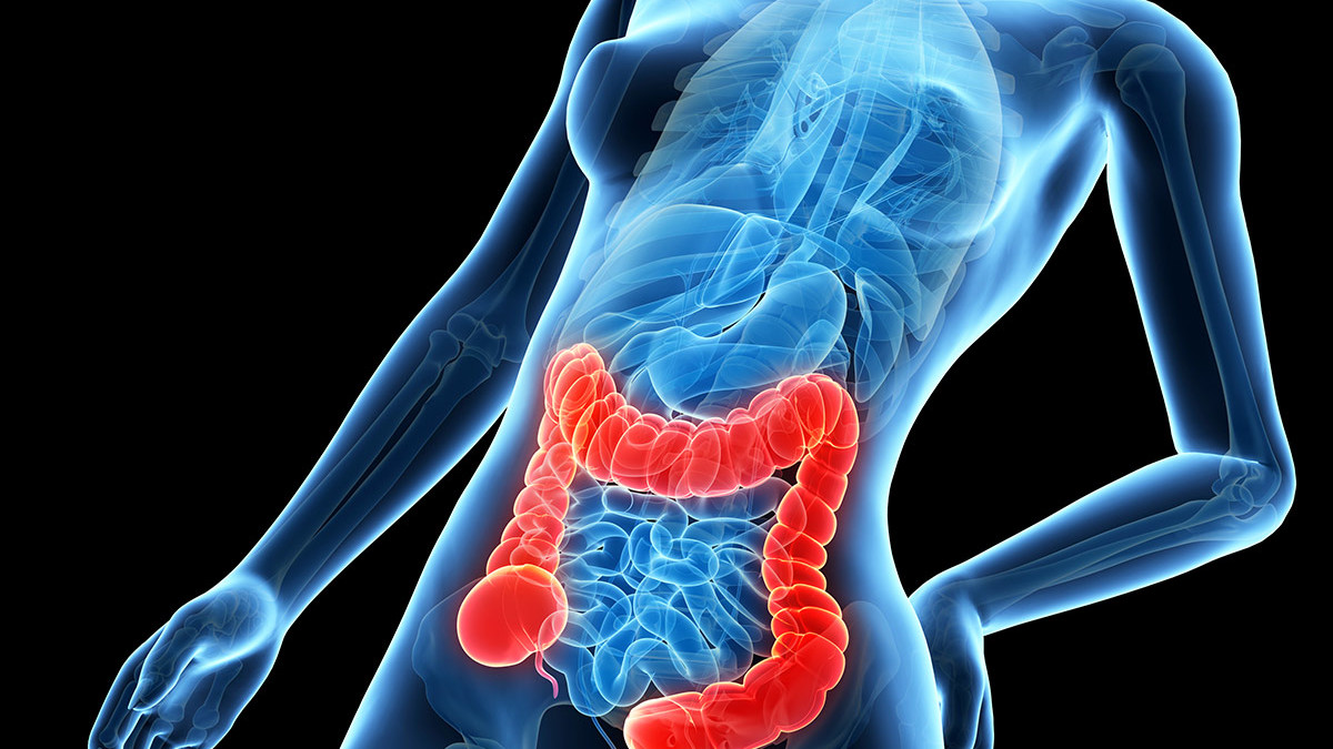 prostatitis o colon irritable